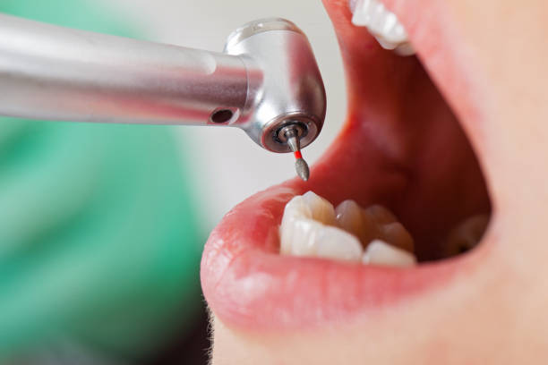 Best Emergency TMJ Treatment in Mead Valley, CA